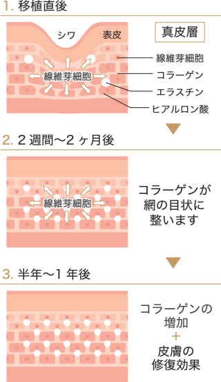 chapter-003-4_0000_chapter-003-4-b